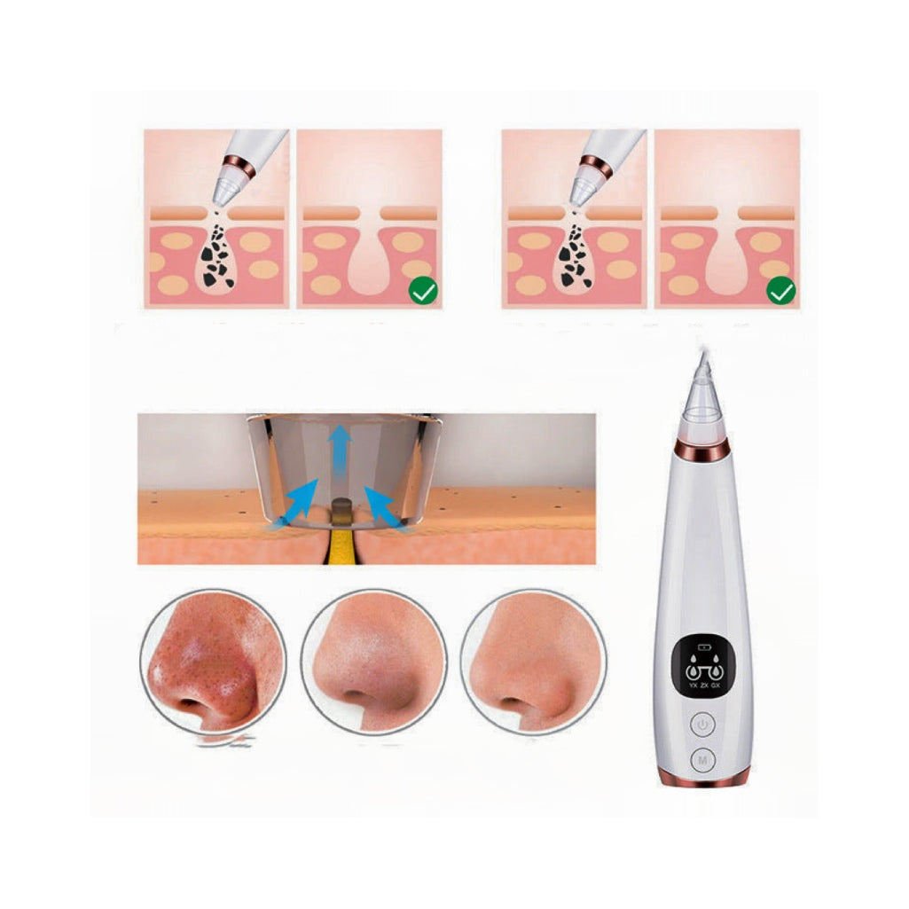 Electric blackhead removal device with 7 suction levels, 7 attachments and rechargeable battery for deep pore cleansing and skin care.